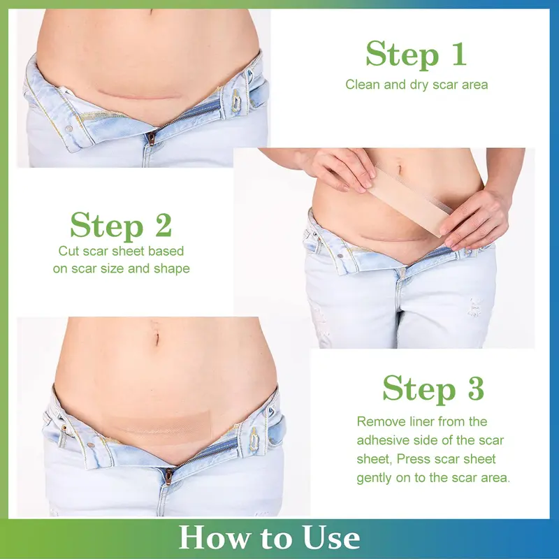 Silicone Scar Sheets & Tape - Treatment for Surgical（Buy 1 Get 1 Free）