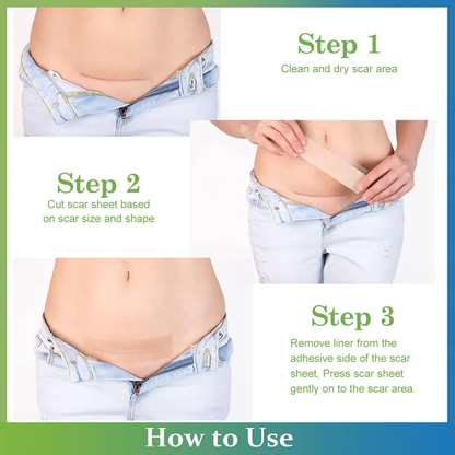 Silicone Scar Sheets & Tape - Treatment for Surgical（Buy 1 Get 1 Free）